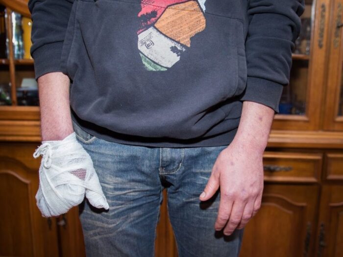 wypadki w rolnictwie, prace polowe, zbiór kukurydzy, belowania siana