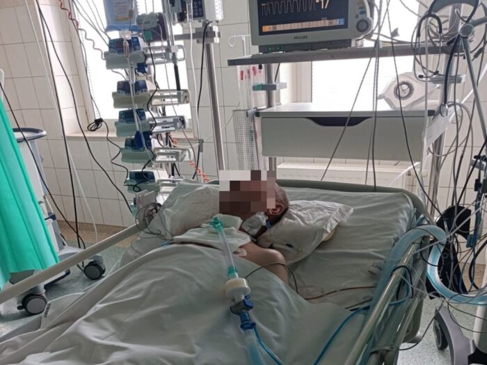 belowanie siana, belarka zmiażdzyła ręce rolnikowi, powiat konecki